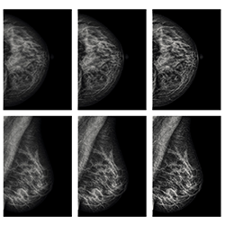 Clarity Breast Imaging