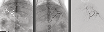 Angiography Package (Option)