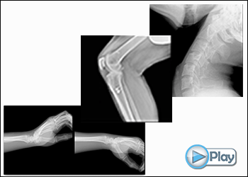 DDR in Orthopaedic Imaging