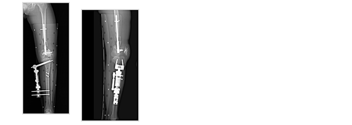 Slot scan digital radiography